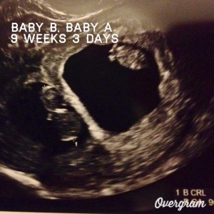 Baby A & B - 9 weeks